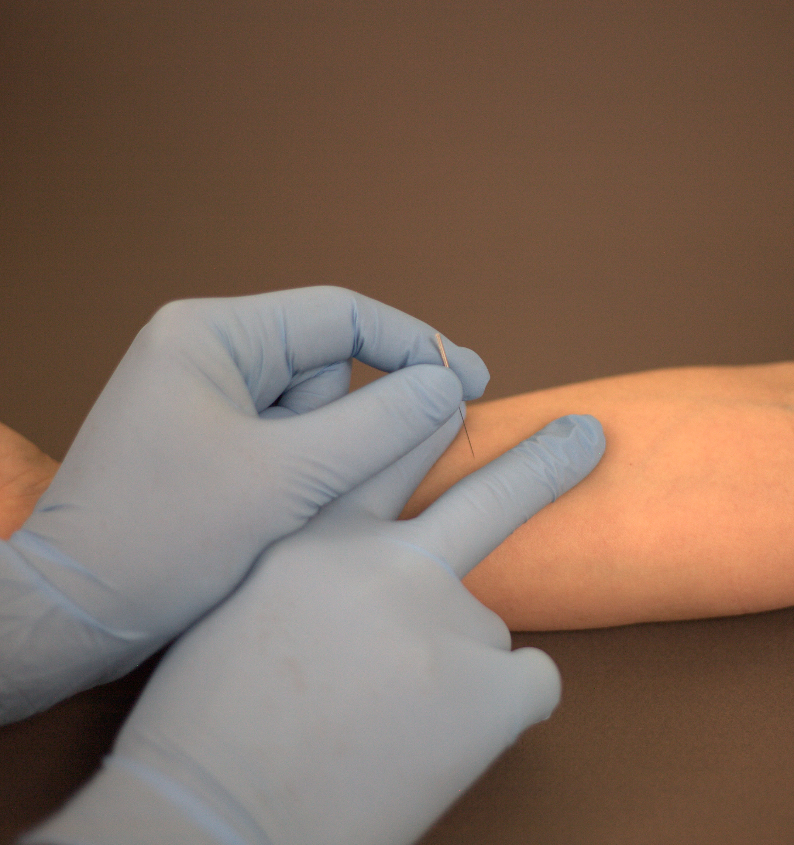 Mojility aps dry needles mojility
